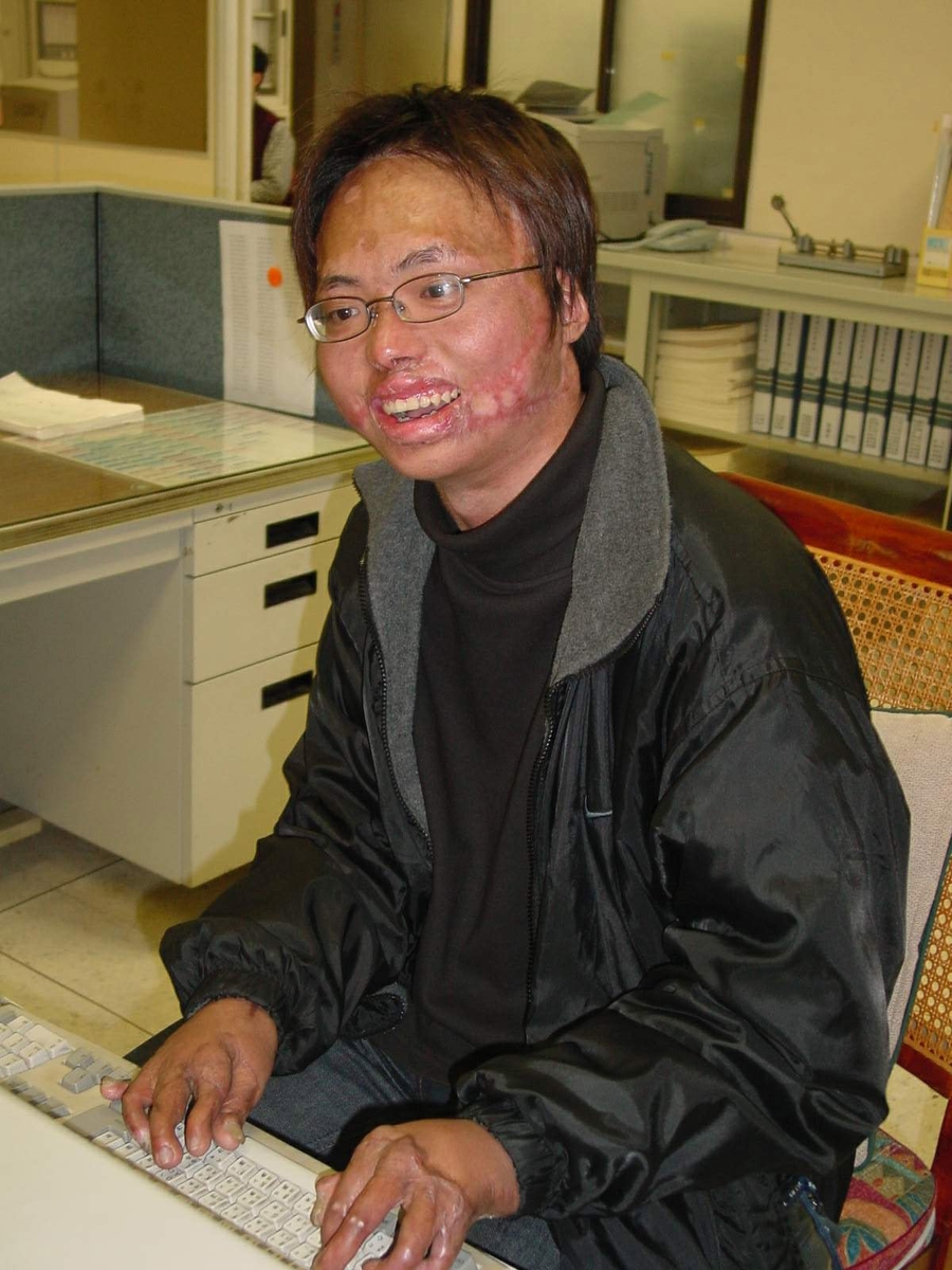 樂觀的吳韋慶認為「上帝關了你這扇門，必定會為你開啟另外一扇窗」。(另開新視窗/jpg檔)圖片